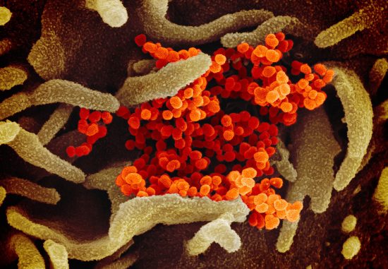 COVID-19 Coronavirus